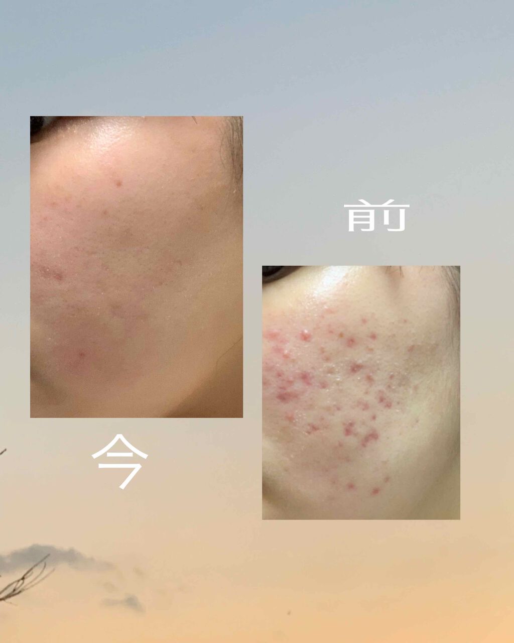 明色美顔水 薬用化粧水/美顔/化粧水を使ったクチコミ（2枚目）