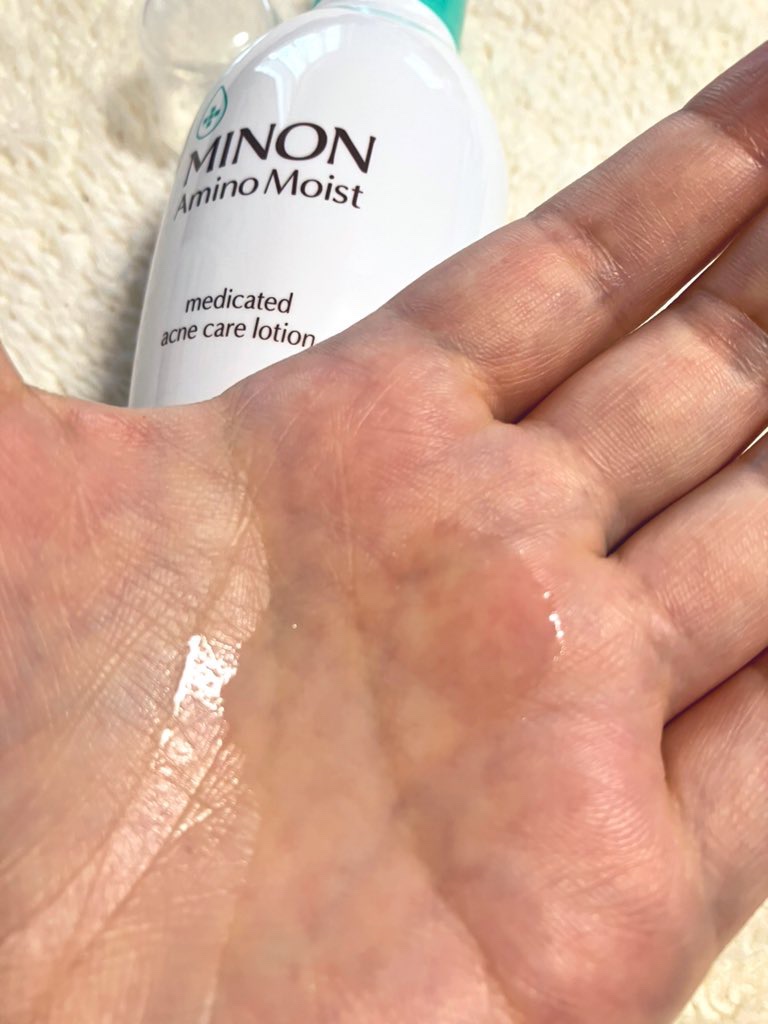 ミノン アミノモイスト 薬用アクネケア ローション/ミノン/化粧水を使ったクチコミ（2枚目）