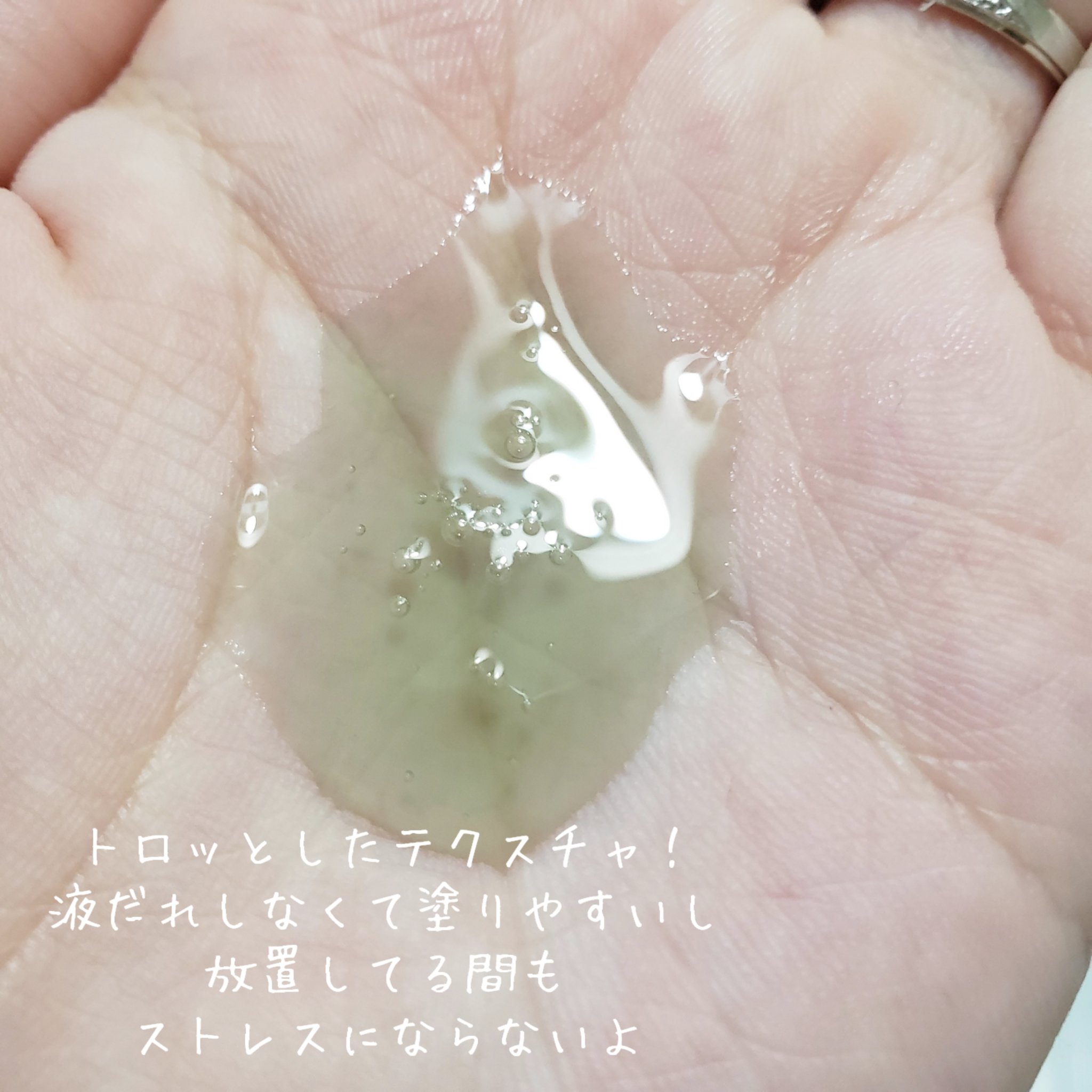 アクネウォッシュ23アンプル/Feld Apotheke/美容液を使ったクチコミ（2枚目）