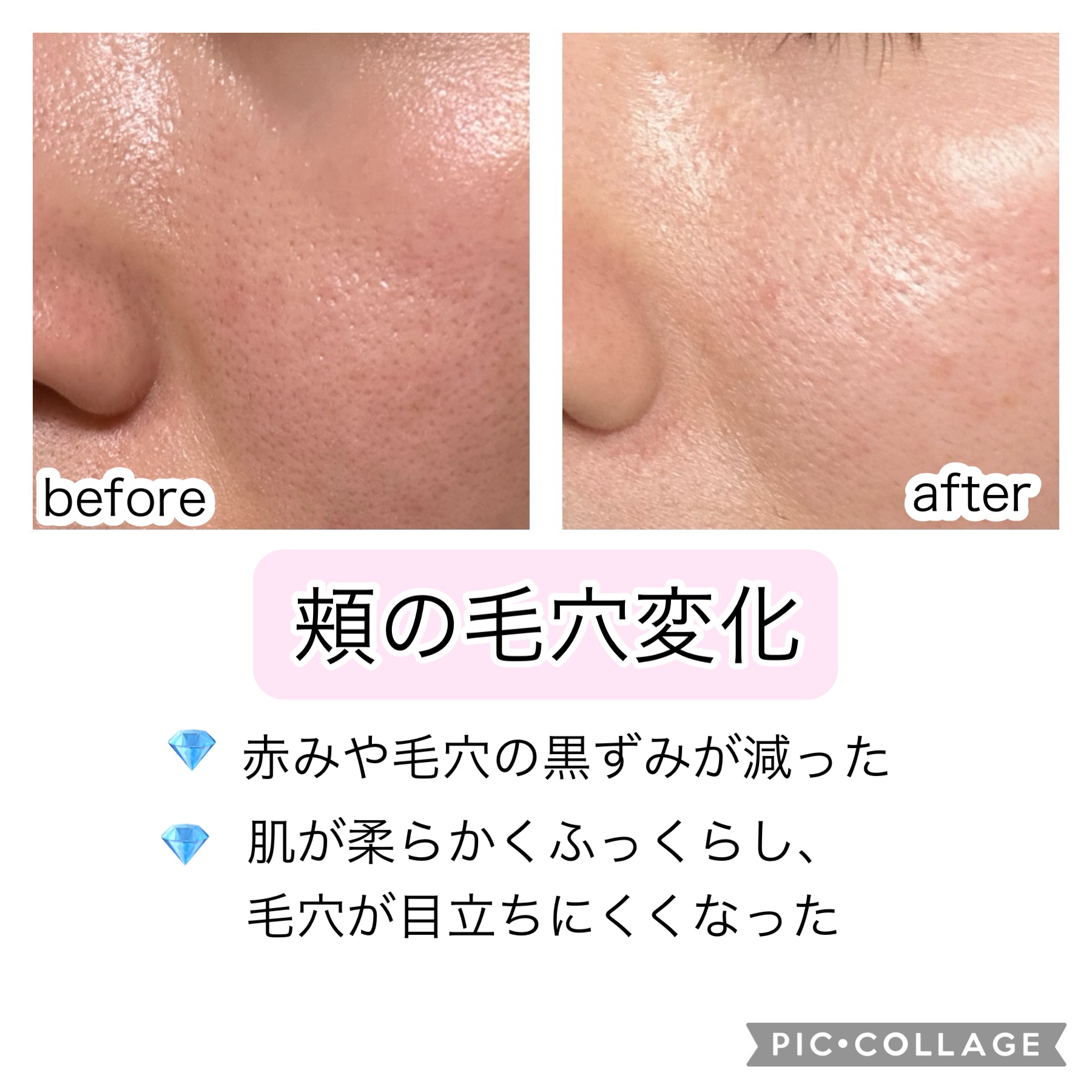 フェイシャル トリートメント エッセンス/SK-II/化粧水を使ったクチコミ（2枚目）