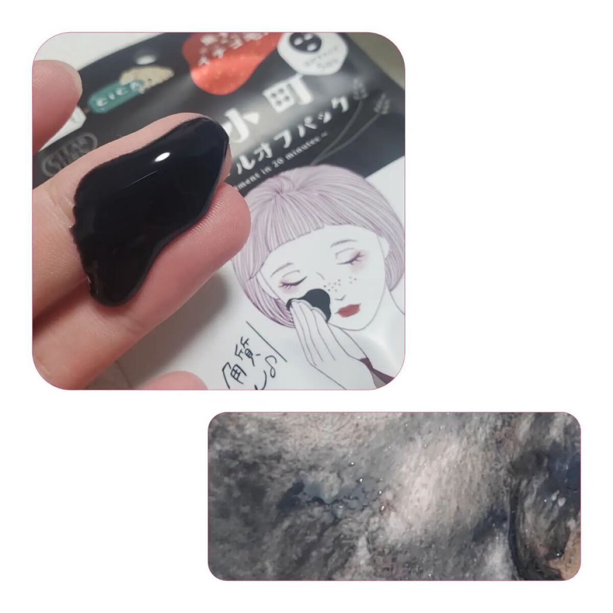 毛穴小町 ブラックピールオフパック/クリアターン/ピーリングを使ったクチコミ（2枚目）