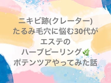 感想と体験メモ📝です。
良かったらお読みください。

#たるみ毛穴 
#ニキビ_ニキビ跡 
私はクレーターよ！

に今更ながら悩みまして。
まずはエステ💆‍♀️で
#ポテンツァ 
やってみた！

エステ