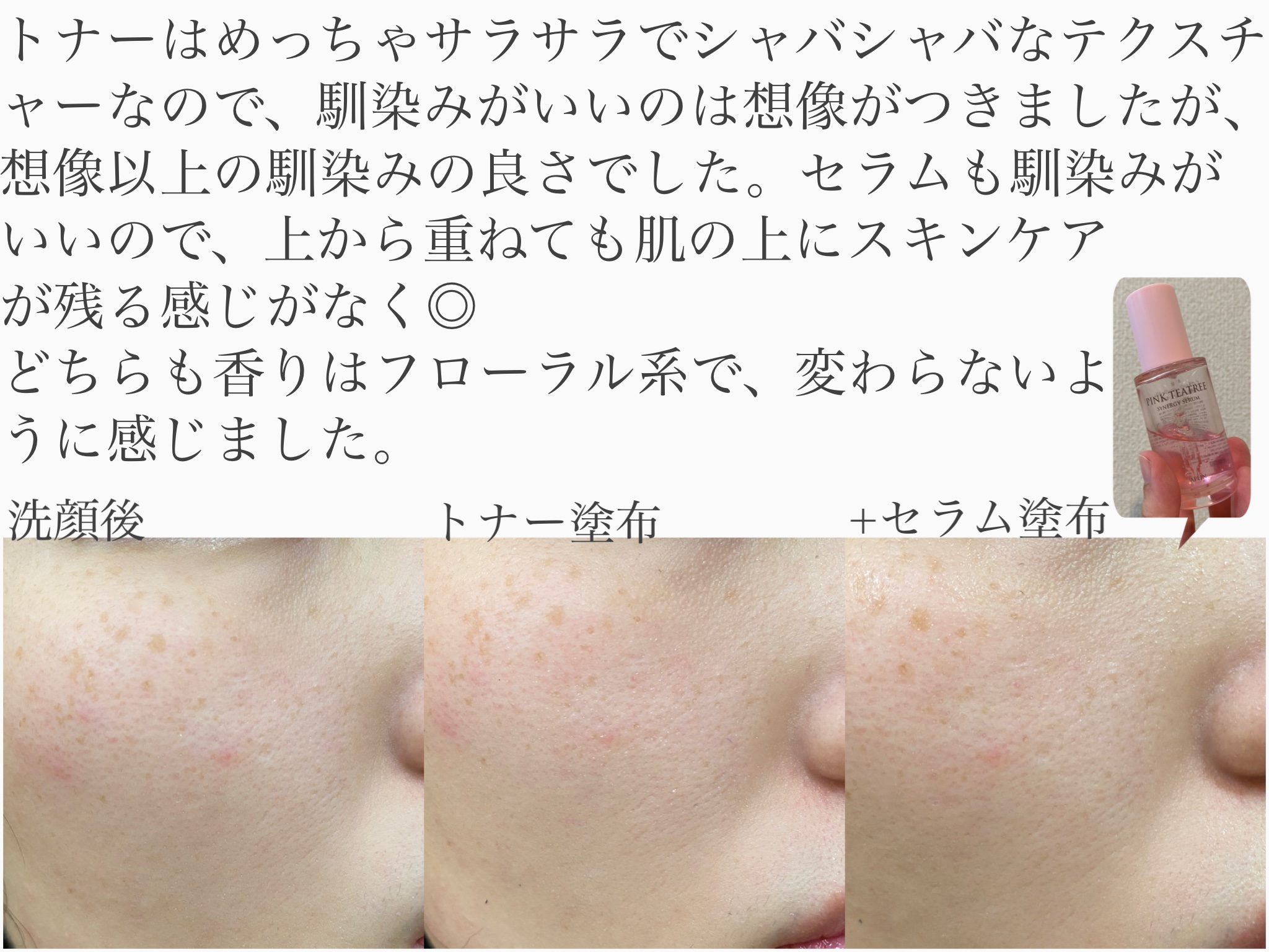 ピンクティーツリートナー/APLIN/化粧水を使ったクチコミ（2枚目）