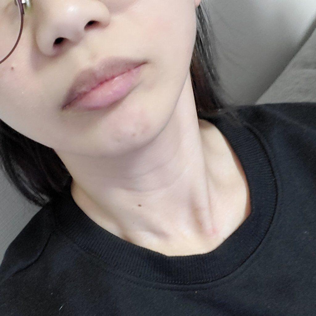 大人の美くびオイル/ハリーハリー/ネック・デコルテケアを使ったクチコミ（3枚目）