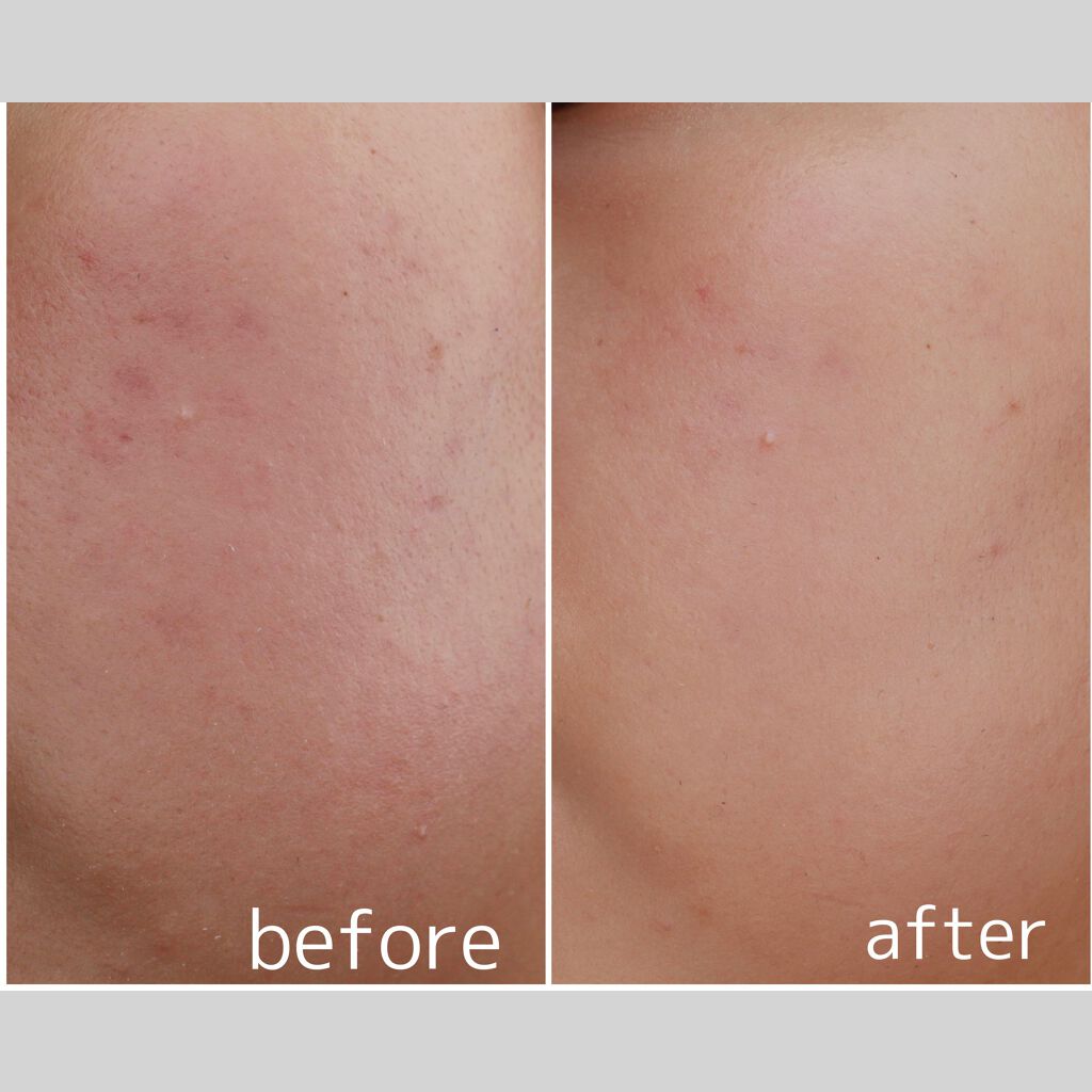 ネオクッション グロウ/LANEIGE/クッションファンデーションを使ったクチコミ(5枚目)