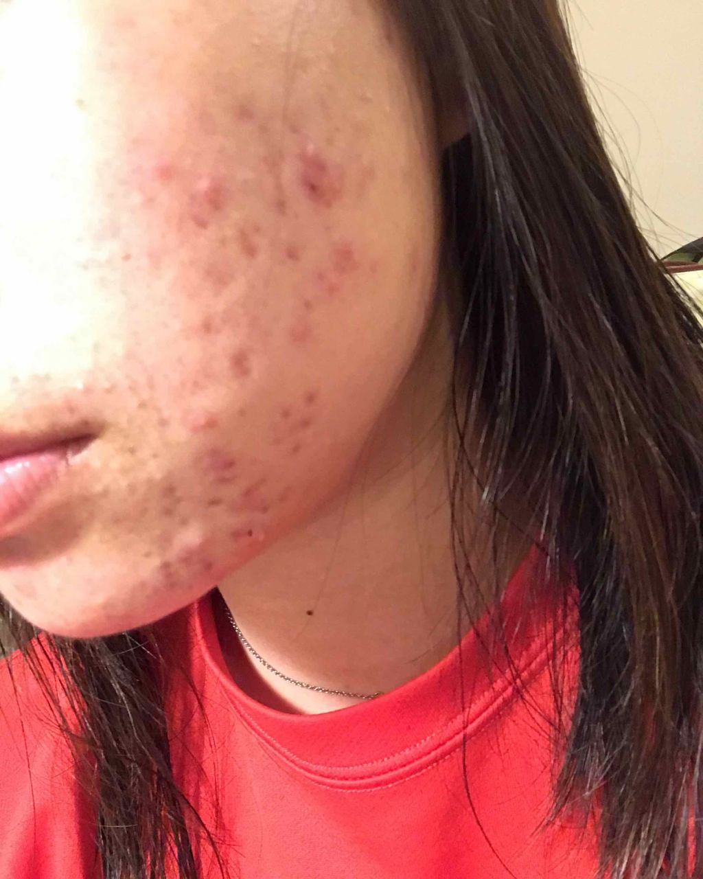 ポム on LIPS 「13日目今日はすごく眠いですおやすみなさい体にいいものを教えて..」(2枚目)