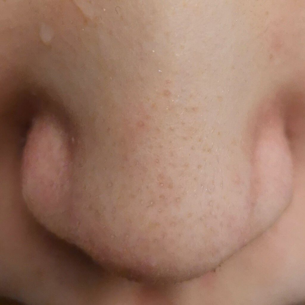 スーパーヴォルカニック　ポア　クレイマスク/innisfree/洗い流すパック・マスクを使ったクチコミ（2枚目）