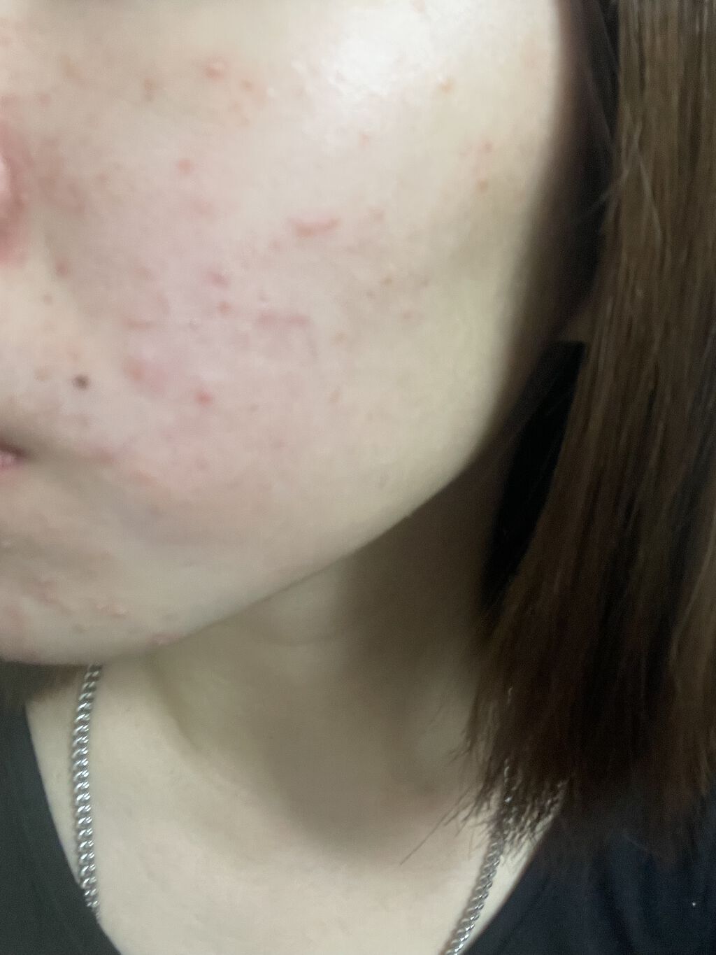 ハトムギ化粧水(ナチュリエ スキンコンディショナー R )/ナチュリエ/化粧水を使ったクチコミ（2枚目）