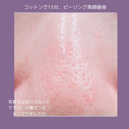 アクレオンセボエクストラクター/ANACIS/その他スキンケアを使ったクチコミ(3枚目)