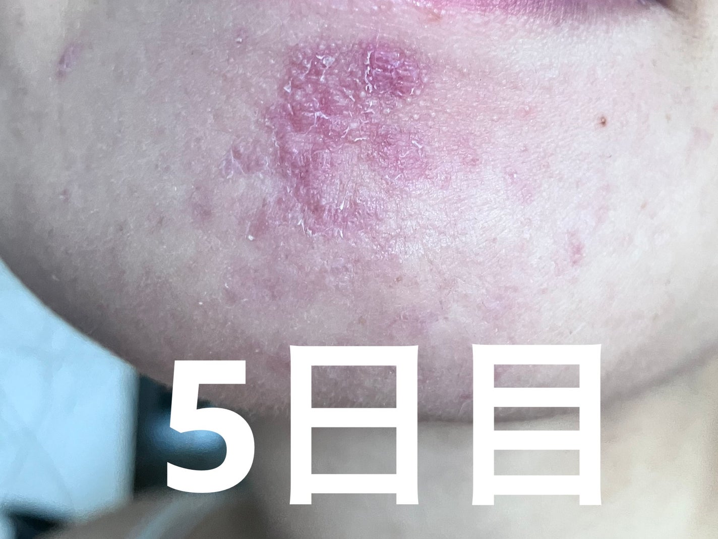 ソフティモ 泡洗顔(セラミド)/ソフティモ/泡洗顔を使ったクチコミ(7枚目)