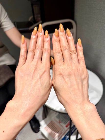 チャコール アワ EXO ウォッシュ/エステプロ・ラボ/泡洗顔を使ったクチコミ(6枚目)