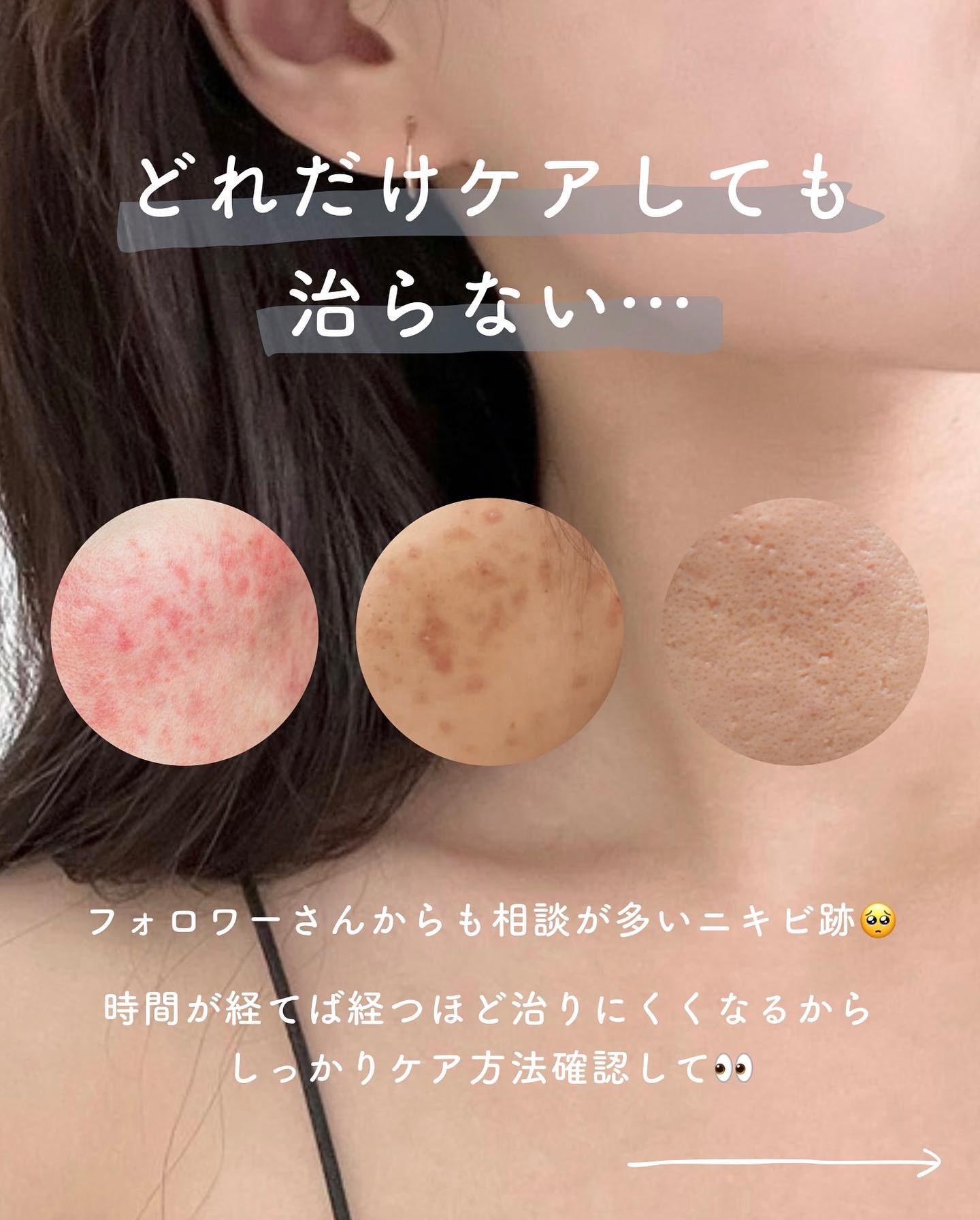 レチノール　シカ　リペア　セラム/innisfree/美容液を使ったクチコミ（1枚目）