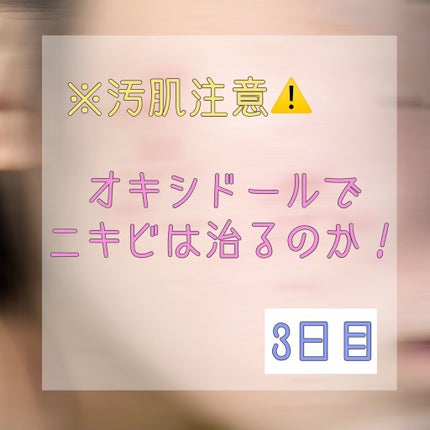 オキシドール(医薬品)/日本薬局方/その他を使ったクチコミ(1枚目)