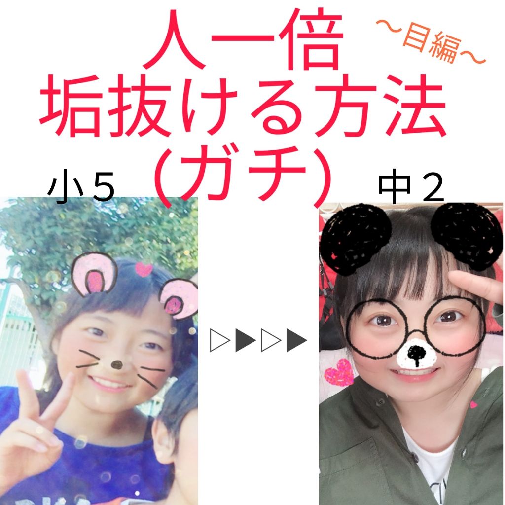 アイビューティー フィクサー WP/アストレア ヴィルゴ/二重まぶた用アイテムを使ったクチコミ（1枚目）