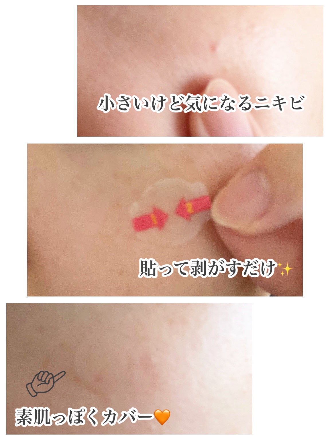キャッチミーパッチ/CATCH ME PATCH/にきびパッチを使ったクチコミ(3枚目)
