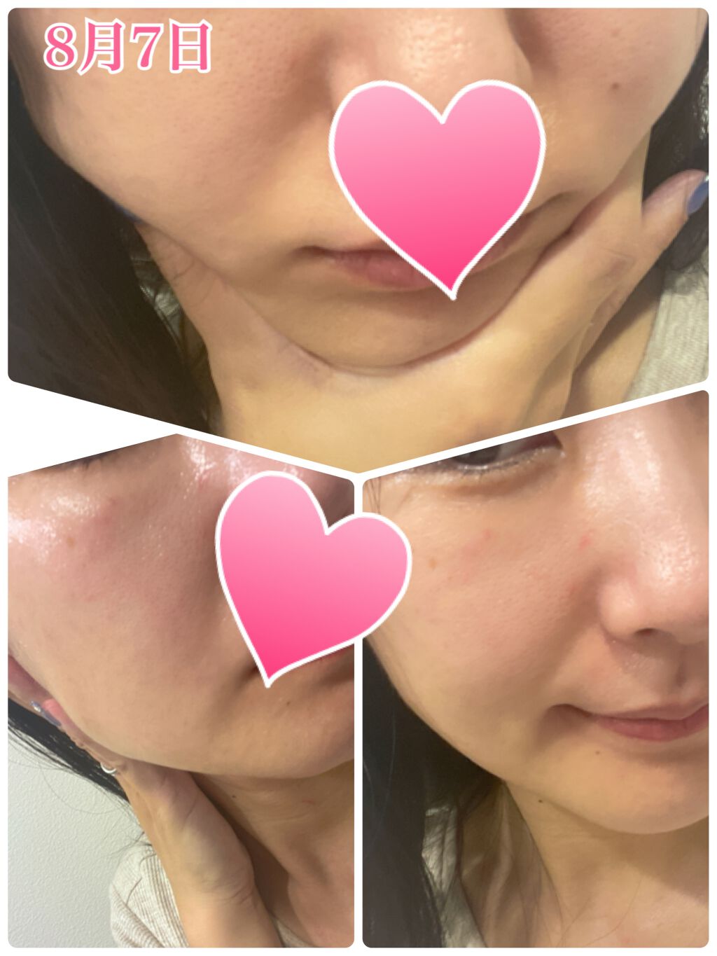 Rin Lift massage pack SF/Rin/その他スキンケアを使ったクチコミ（3枚目）