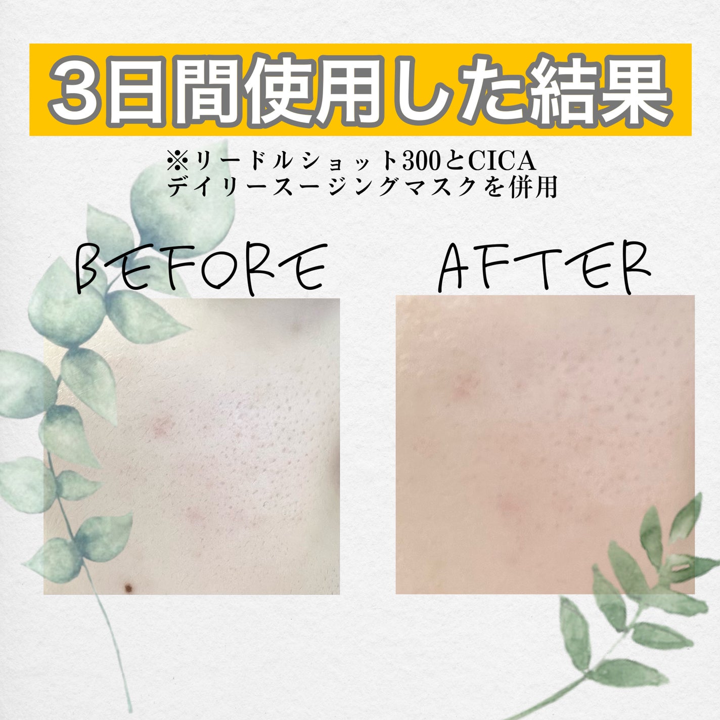 リードルショット300/VT/美容液を使ったクチコミ(4枚目)