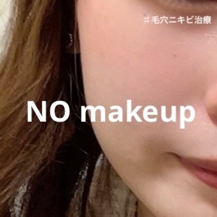 ももぷり フレッシュピールオフパック/ももぷり/ピーリングを使ったクチコミ(1枚目)