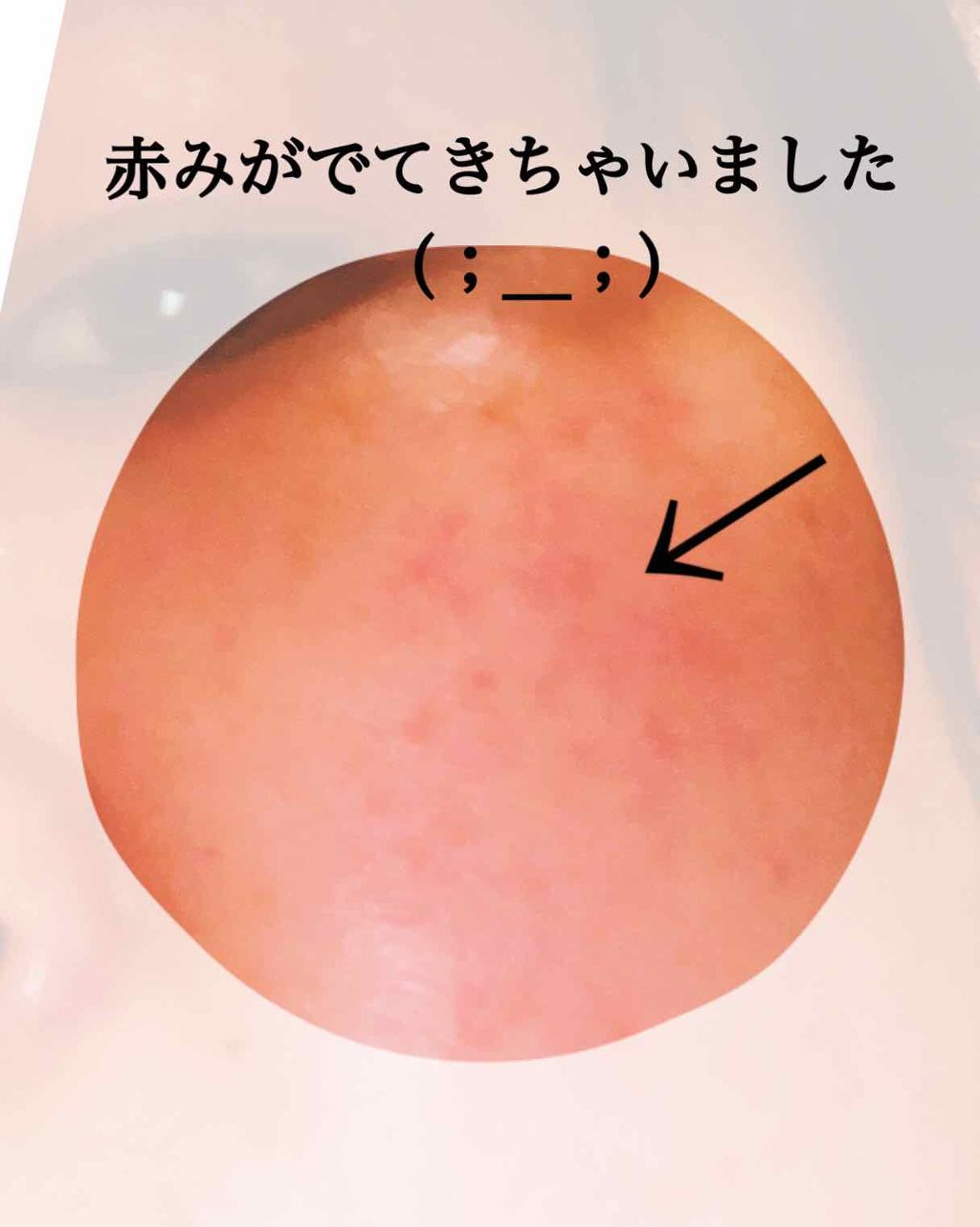 オルビスユー ローション/オルビス/化粧水を使ったクチコミ(4枚目)