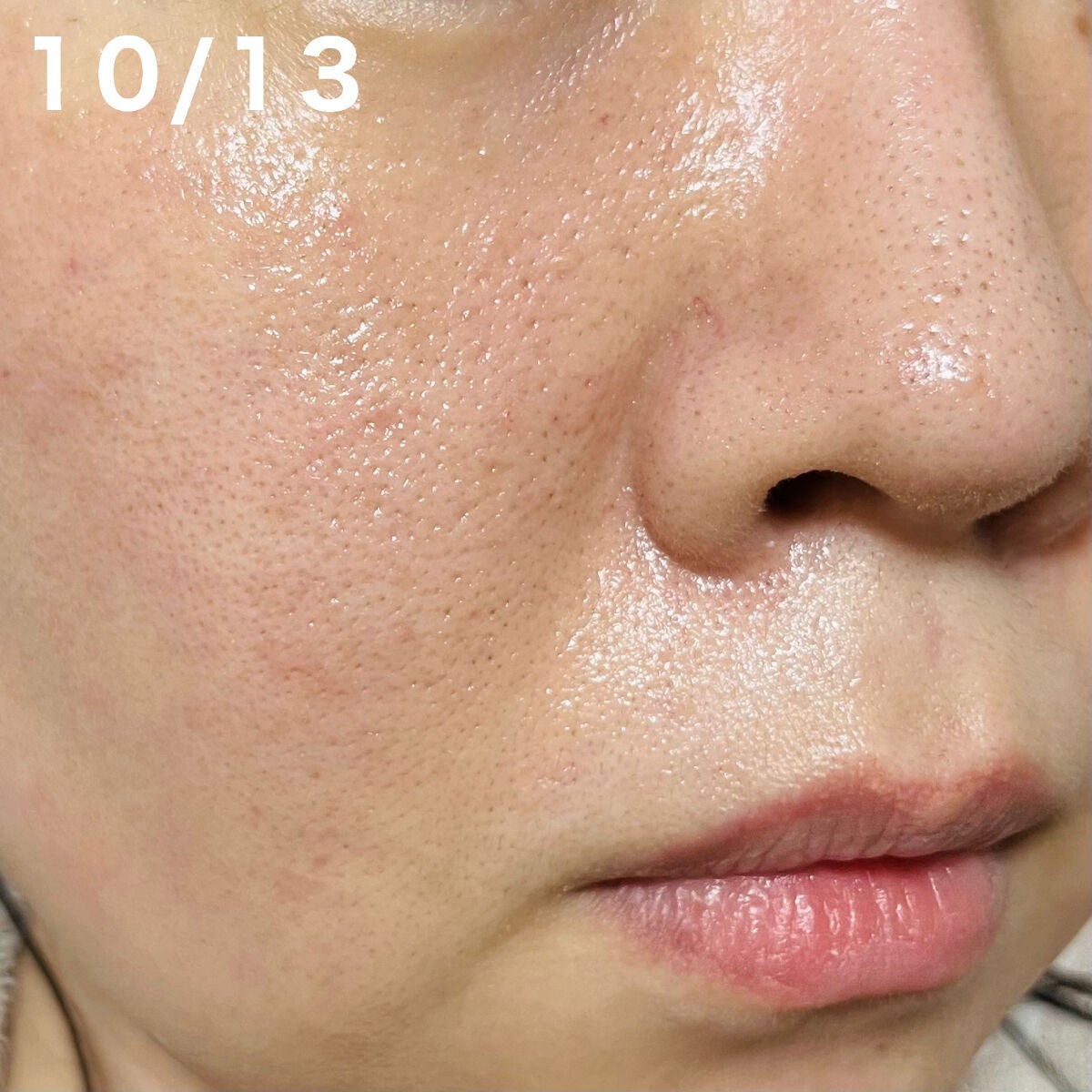 Cサスペンション23+HAスフィア2フェイスクリーム/The Ordinary/美容液を使ったクチコミ(4枚目)