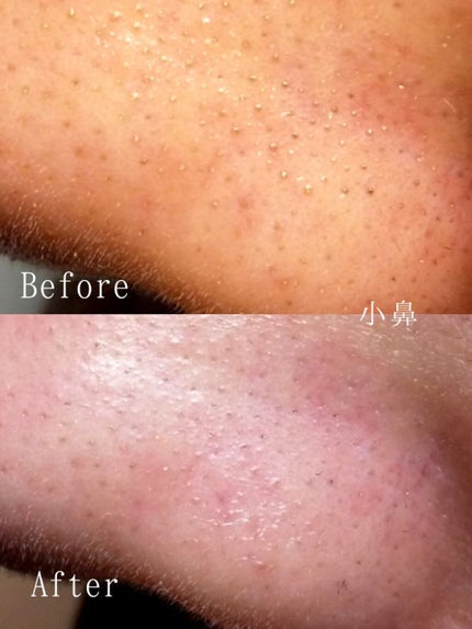 を使ったクチコミ(3枚目)