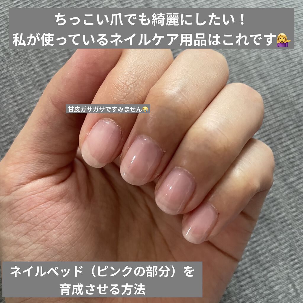 ネイルトリートメント N ネイルネイルを使った口コミ ちっこい爪でも綺麗に 整えながらネイルベ By 天使コスメちゃん 敏感肌 代前半 Lips