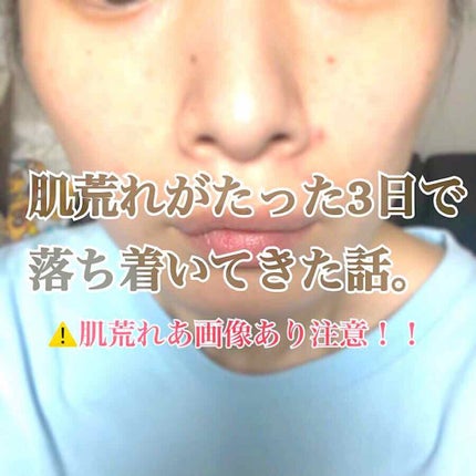 明色美顔水 薬用化粧水/美顔/化粧水を使ったクチコミ(1枚目)