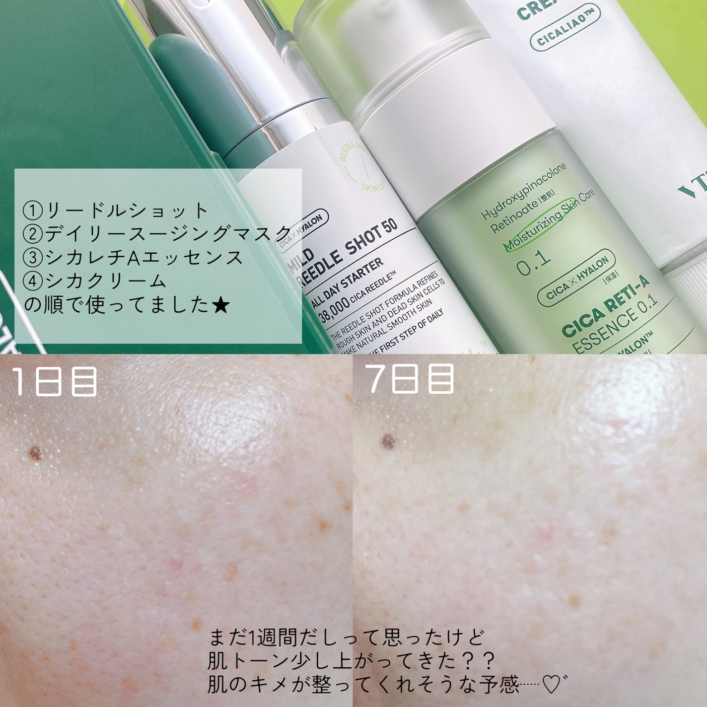 CICA クリーム/VT/フェイスクリームを使ったクチコミ(2枚目)