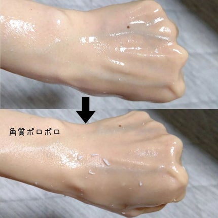 全身角質クリアゲル/NONON(ノンノン)/ピーリングを使ったクチコミ(2枚目)