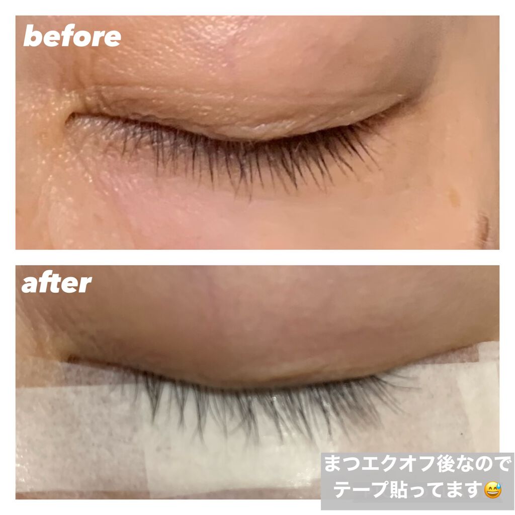 まつげ美容液（まつげ・目もと美容液）/UZU BY FLOWFUSHI/まつげ美容液を使ったクチコミ（2枚目）