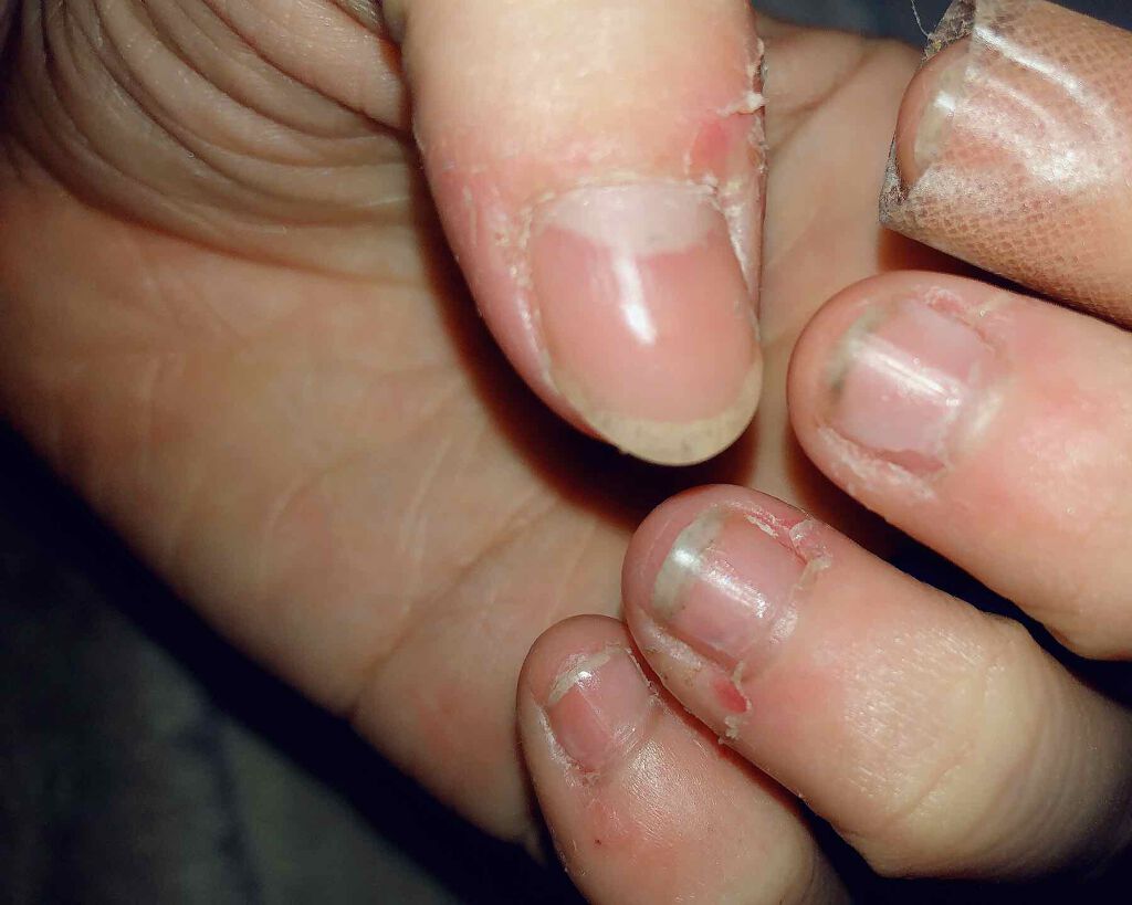 カラフルネイルズ ネイルハードナー/キャンメイク/ネイルトップコートを使ったクチコミ(2枚目)