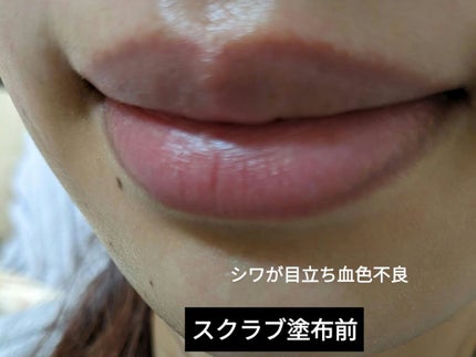 を使ったクチコミ(2枚目)