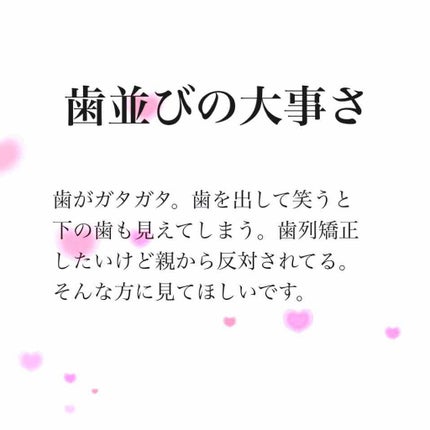 マウスピース矯正/その他を使ったクチコミ(1枚目)