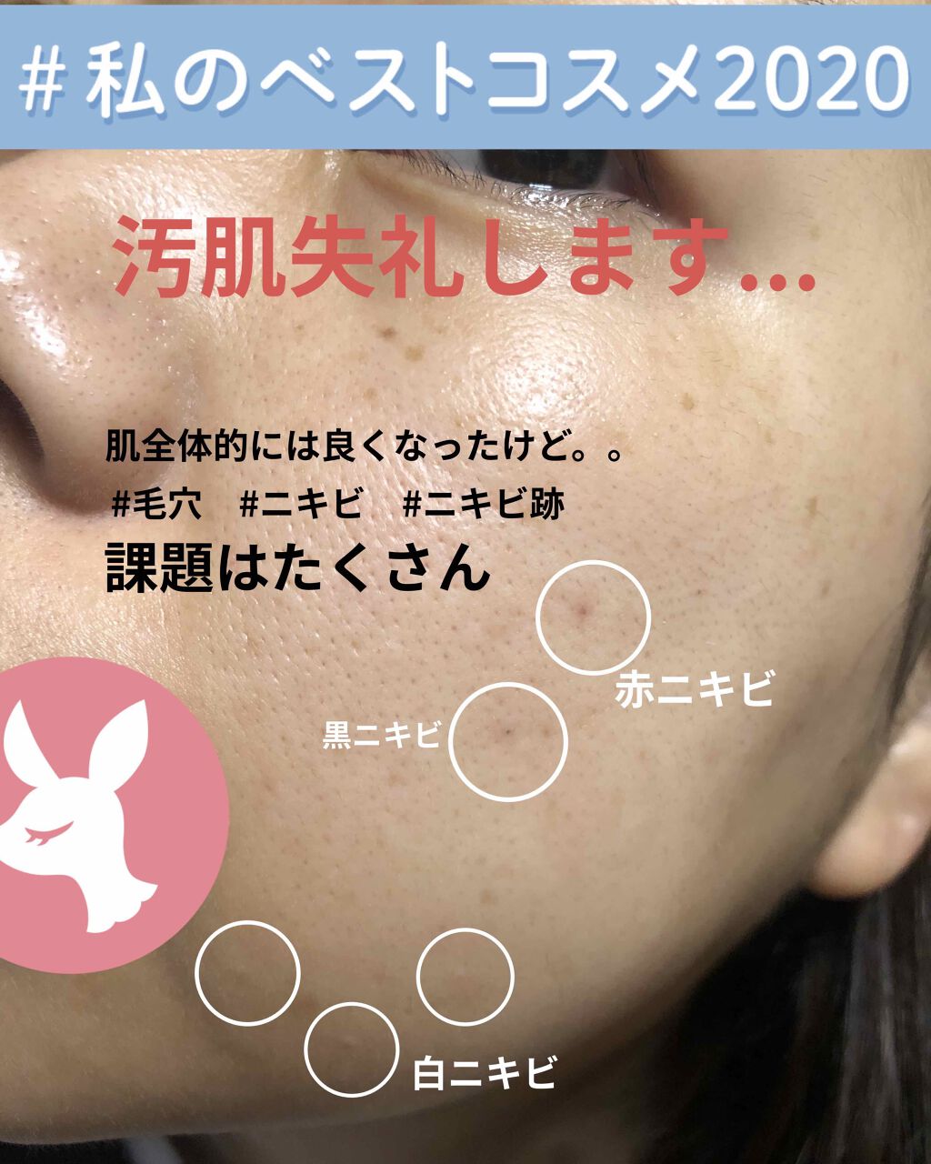 メイク落としジェル/オードムーゲ/クレンジングジェルを使ったクチコミ(1枚目)