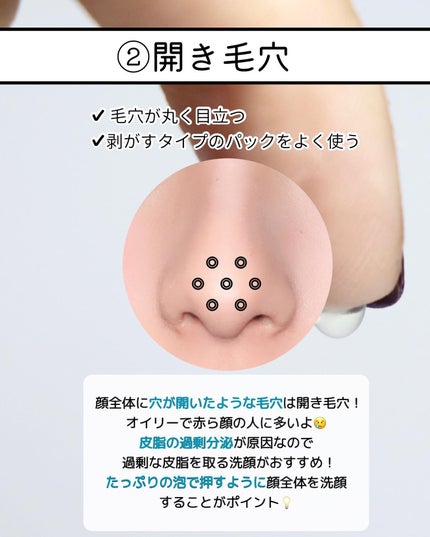 VC100エッセンスローション EX/ドクターシーラボⓇ/化粧水を使ったクチコミ(5枚目)