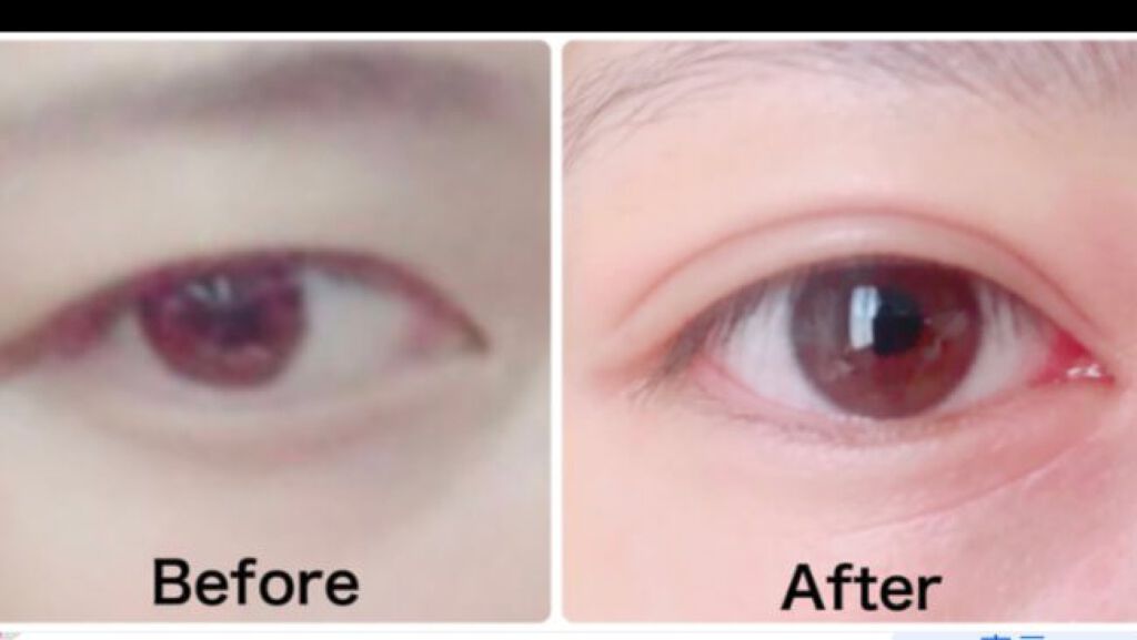 アイトーク スーパーウォータープルーフ/アイトーク/二重まぶた用アイテムを使ったクチコミ(6枚目)