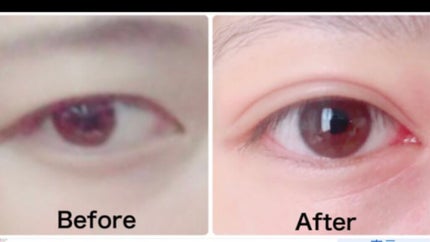 アイトーク スーパーウォータープルーフ/アイトーク/二重まぶた用アイテムを使ったクチコミ(6枚目)