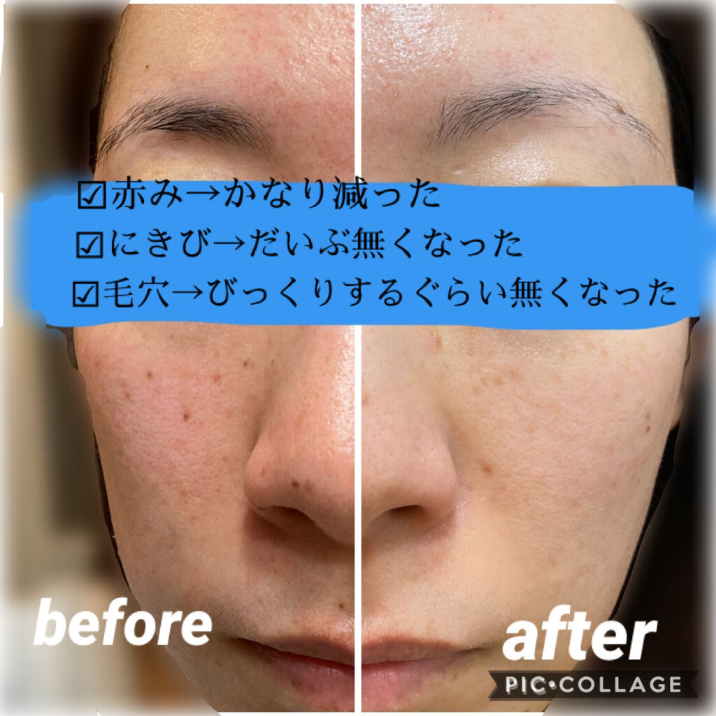 クレンジング フレッシュフォームe/IPSA/洗顔フォームを使ったクチコミ（2枚目）