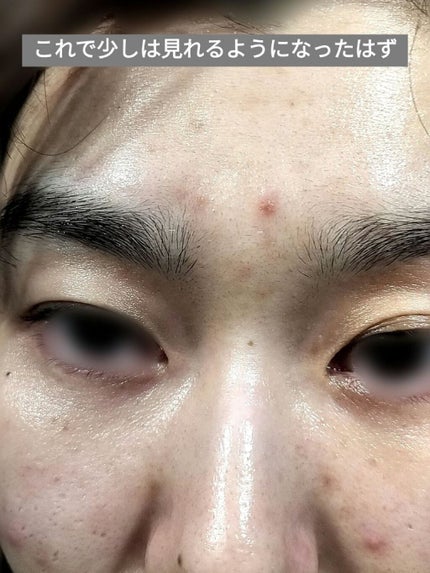 NITENA/LOABI/美顔器・マッサージを使ったクチコミ(7枚目)