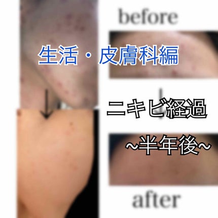 を使ったクチコミ(1枚目)