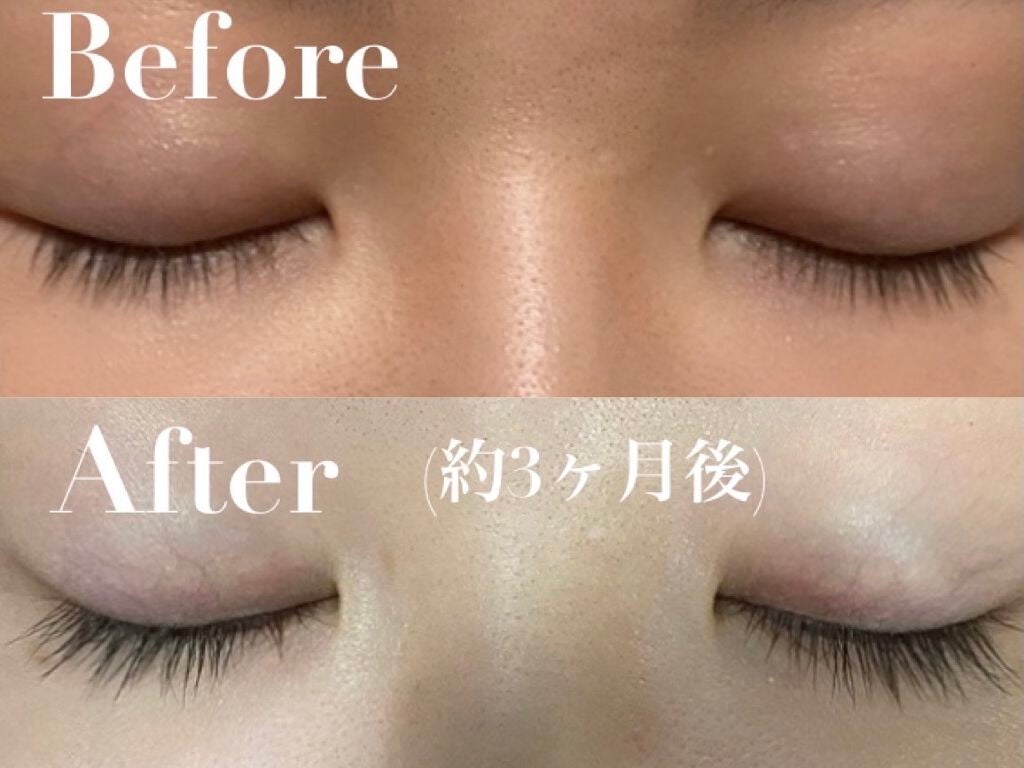 EMAKED(エマーキット)/水橋保寿堂製薬/まつげ美容液を使ったクチコミ(3枚目)