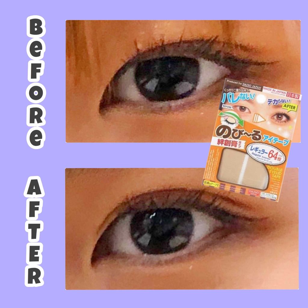 のびーるアイテープ（絆創膏タイプ、レギュラー）/DAISO/二重まぶた用アイテムを使ったクチコミ（2枚目）