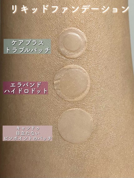 エラバンドパッチ/ElaBAND/その他を使ったクチコミ(6枚目)