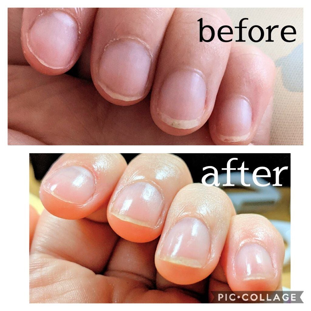 爪ミガキセット/デュカート/ネイル用品を使ったクチコミ(2枚目)