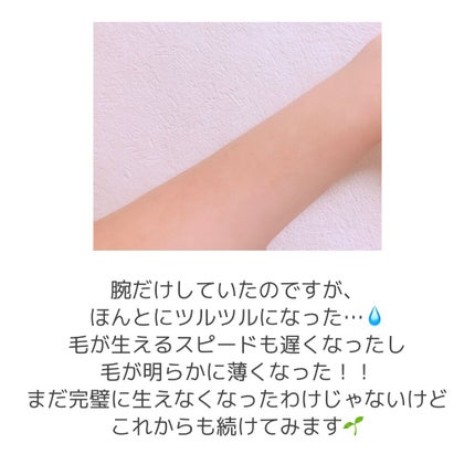 サファイヤIPL光脱毛器/NiZmir/家庭用脱毛器を使ったクチコミ(5枚目)