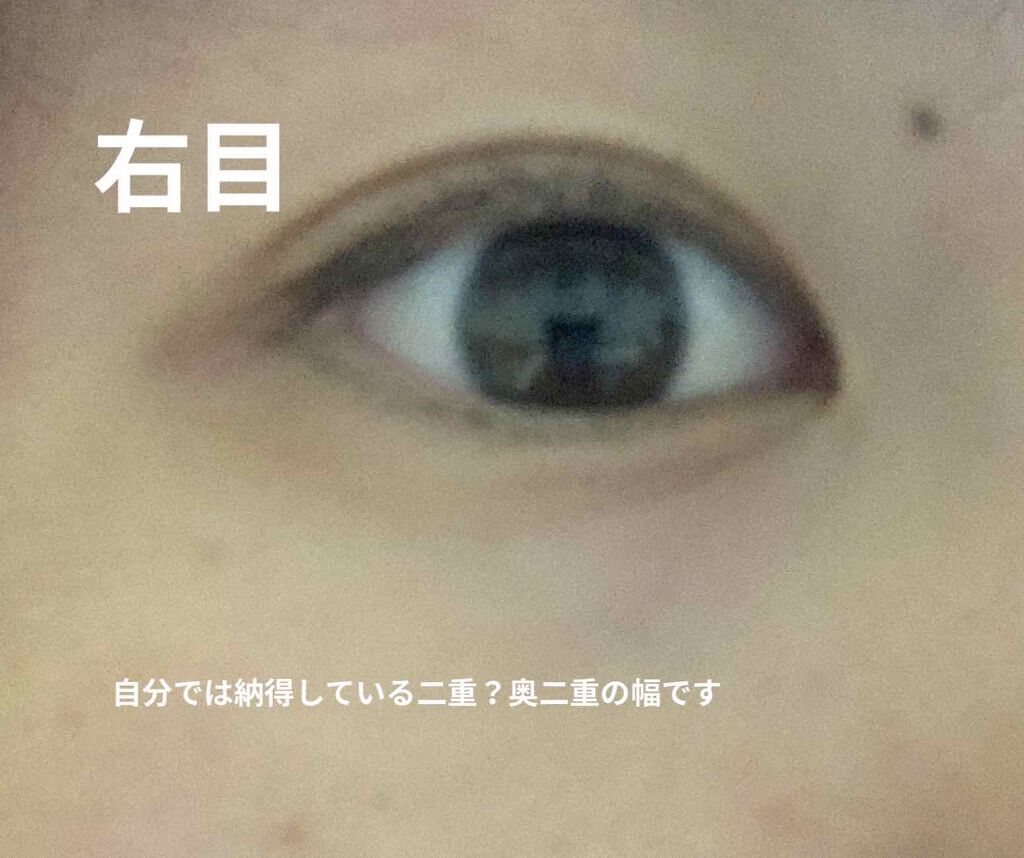 アイビューティー フィクサー WP/アストレア ヴィルゴ/二重まぶた用アイテムを使ったクチコミ（2枚目）
