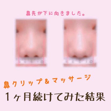 鼻クリップ/ロフトファクトリー/その他を使ったクチコミ（1枚目）