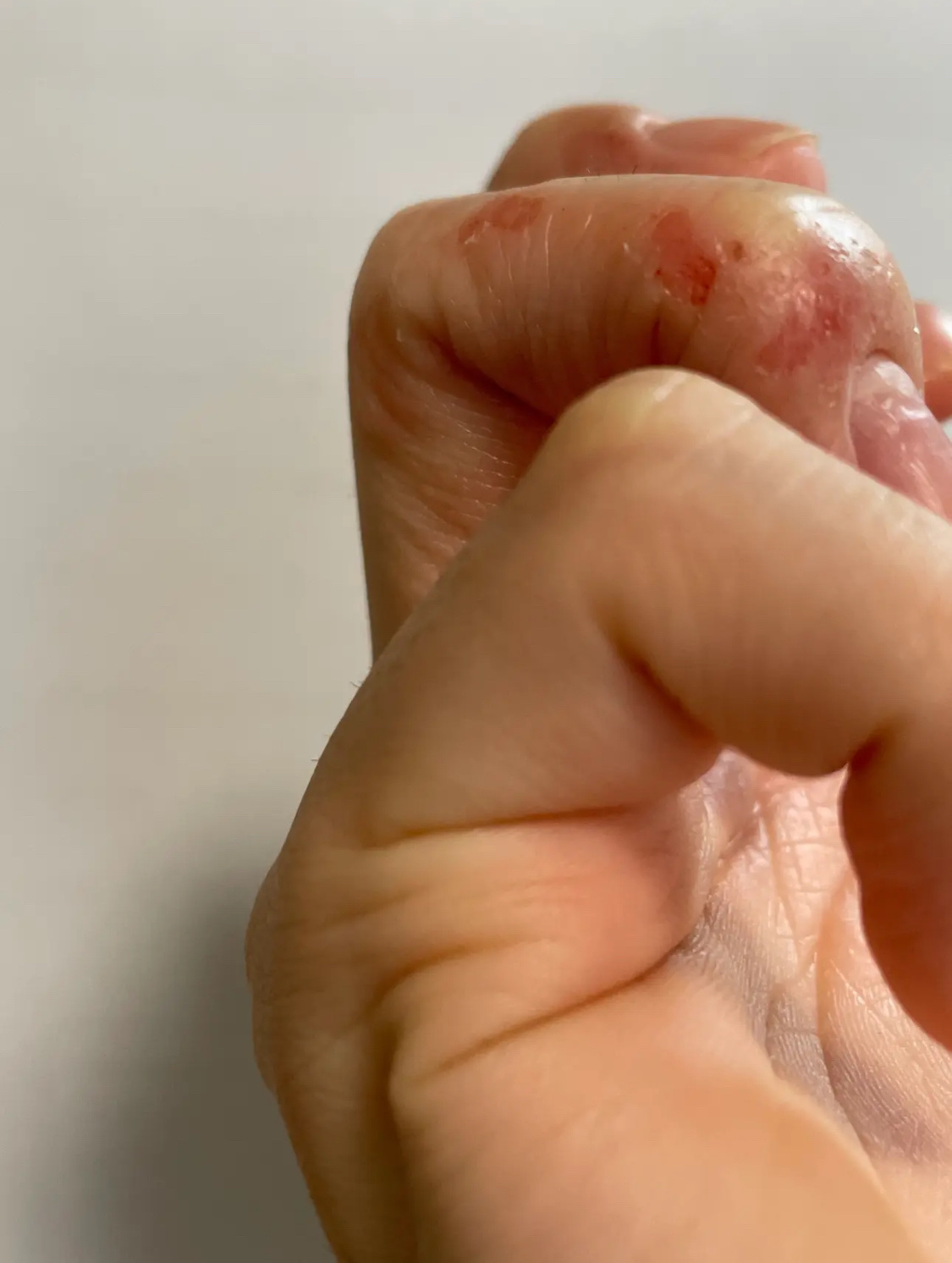 ニベアクリーム/ニベア/ボディクリームを使ったクチコミ（2枚目）