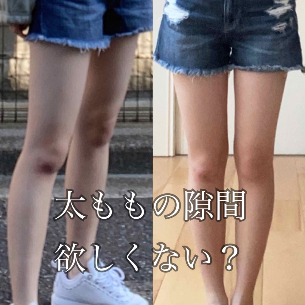 寝ながらメディキュット スパッツ 骨盤テーピング/メディキュット/着圧ソックス・レギンスを使ったクチコミ（1枚目）