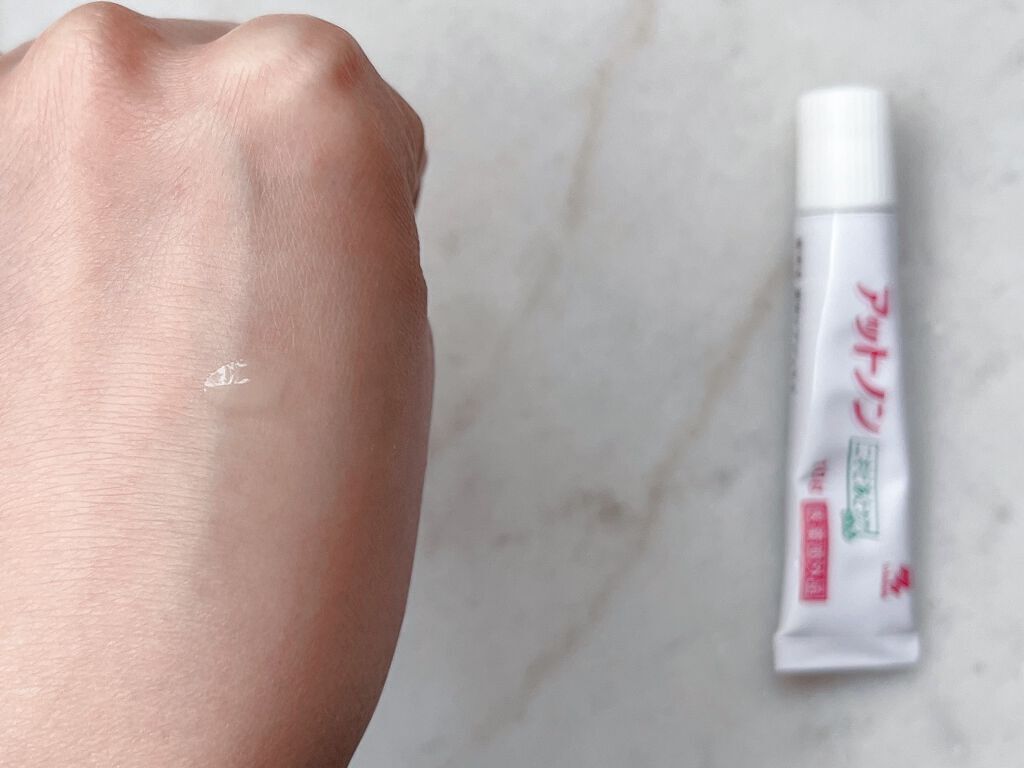 ニキビあとケアジェル/アットノン/その他スキンケアを使ったクチコミ(2枚目)